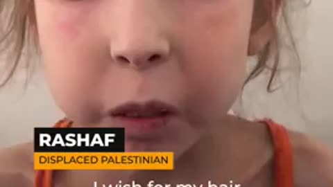 starving girl from Gaza