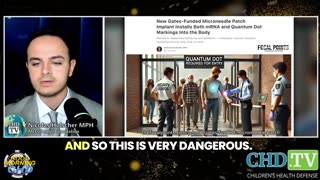 Meet Bill Gates’ new microneedle patch implant that installs BOTH modified mRNA