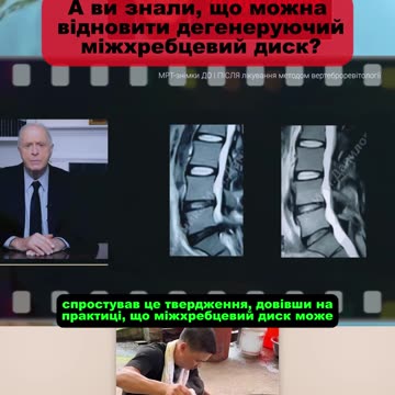 Операція? Забудь! Її можна уникнути — і ось як 👇