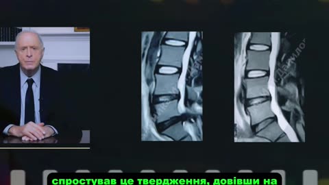Операція? Забудь! Її можна уникнути — і ось як 👇