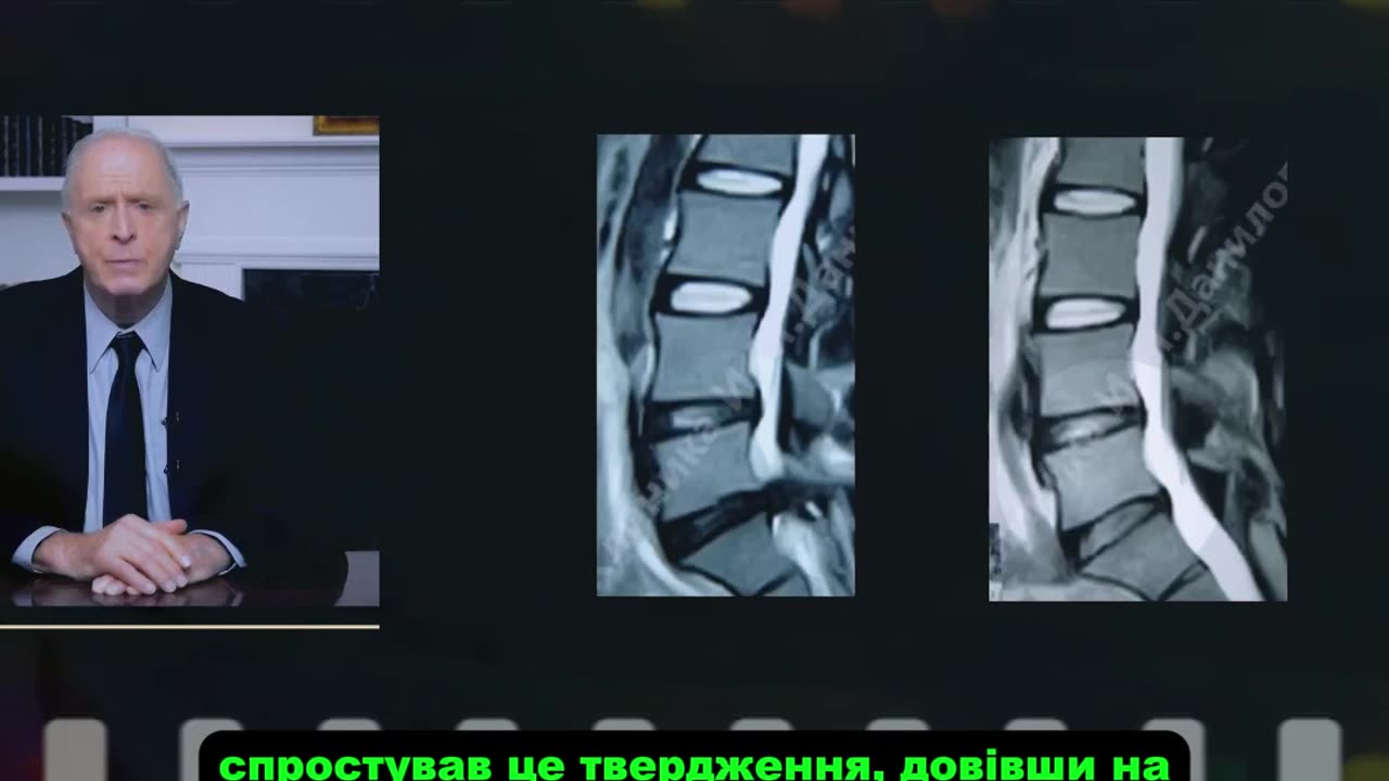 Операція? Забудь! Її можна уникнути — і ось як 👇