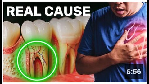 "Unveiling the Unknown #1 Cause of Heart Attacks and Strokes"