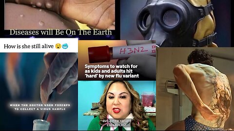 Unheard of - Incurable Pestilences - Horrible Epidemics not mentioned in the Holy Bible in Divers places #pestilences