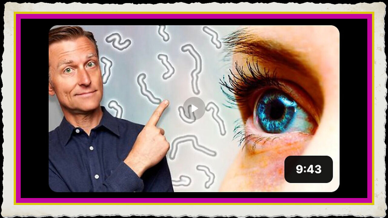 What Causes Eye Floaters and Dry Eyes