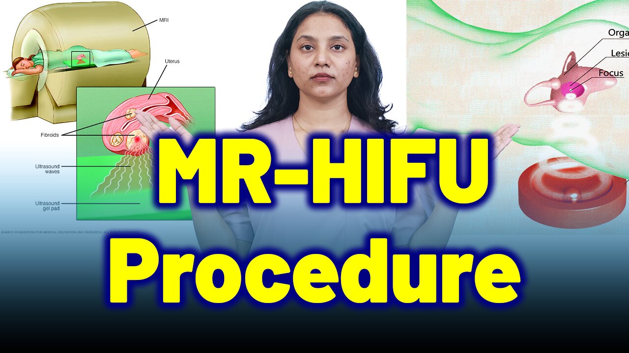Inside the MR-HIFU, Non-Surgical, Sound Wave Procedure for Fibroids. | Treatment & Cure | Homeopathy