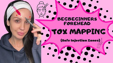Beginners Forehead Tox Mapping (safe injection zones)