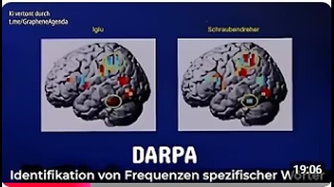 Die drahtlose Gehirn Computer Schnittstelle der DARPA, die Nanotech & KI nutzt, ist das neue MKULTRA