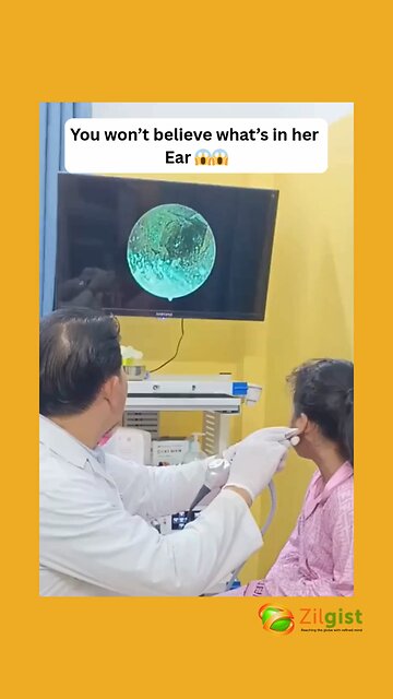 You won't believe what's in her Ear 😱😱