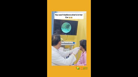 You won't believe what's in her Ear 😱😱