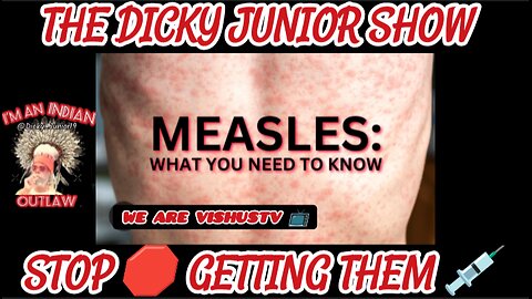 The Dicky Junior Show: Monday Evening Measles "RANT" #VishusTv 📺