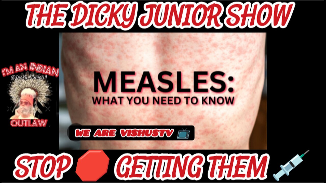 The Dicky Junior Show: Monday Evening Measles "RANT" #VishusTv 📺