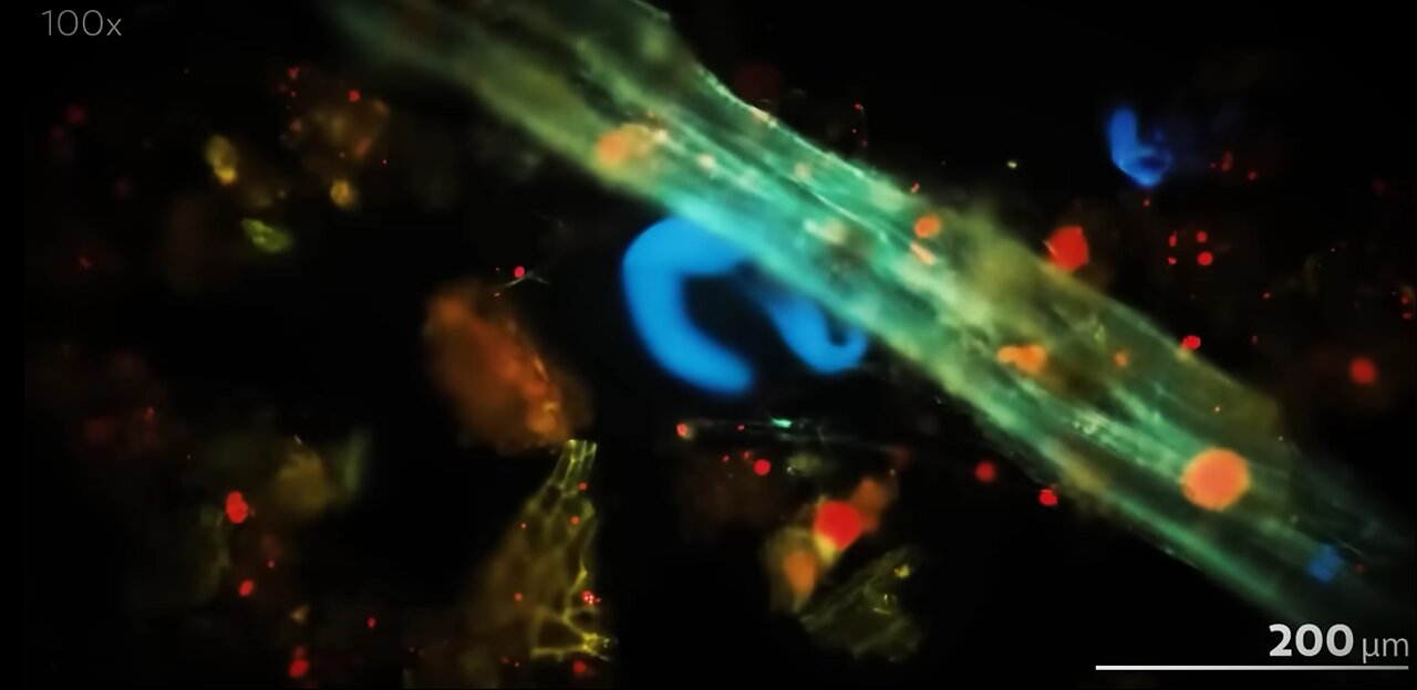 Dr. Jack Kruse: Sunlight Exposure Prevents Chronic Disease