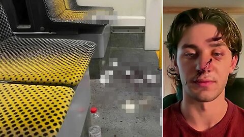 American Stabbed Defending Women On German Tram Condemns Immigration Policies After Suspect Released