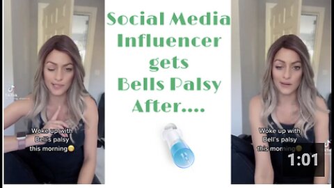"Bells Palsy Strikes Social Media Influencer Post-Vaccination"