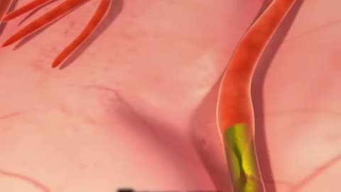 Your brain makes insulin just like the pancreas