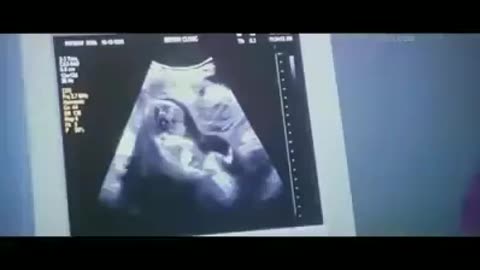 #ABORTO - “ECCO COME VENGONO UCCISI DA OLTRE QUARANT'ANNI, 🛑NELL'ASSORDANTE SILENZIO GENERALE, I BAMBINI (solo in Italia sei milioni di innocenti uccisi) NEL GREMBO MATERNO!!”👿👹👿=ALTRO CHE FARSA PANDEMICA DA COVID19!!=