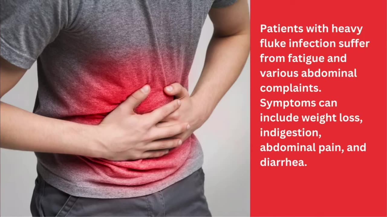 People in the U.S. get infected with liver flukes P1