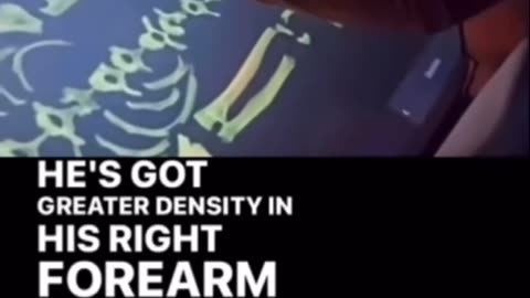 Forearm analysis