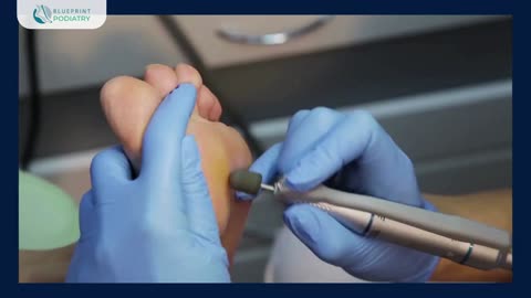 Specialised Footcare Services Long Jetty for Lasting Relief | Blueprint Podiatry