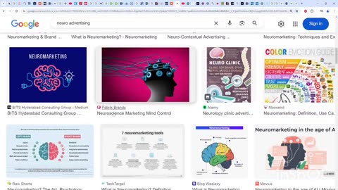 Darpa, DOW & Neural Interfaces