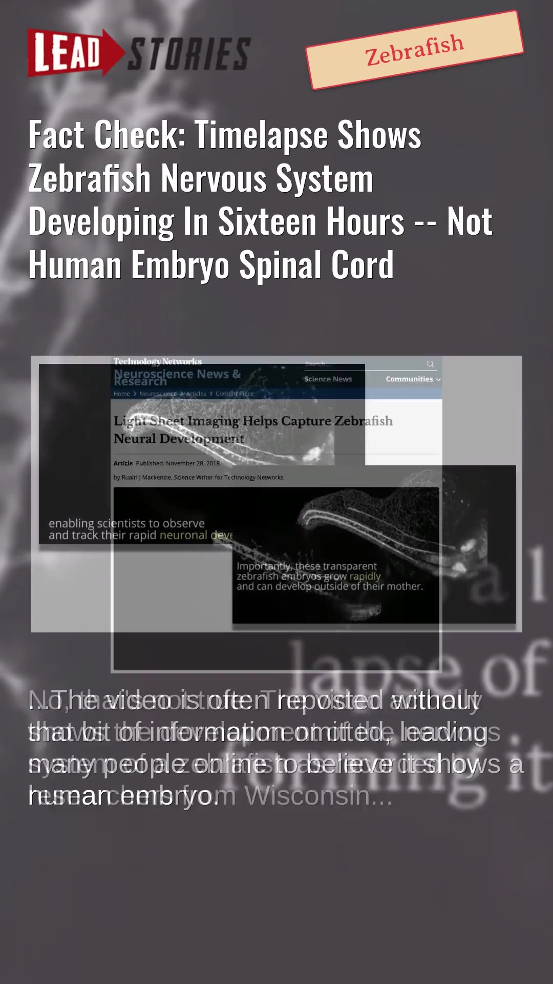 Fact Check: Timelapse Shows Zebrafish Nervous System Developing In Sixteen Hours -- Not Human Embryo