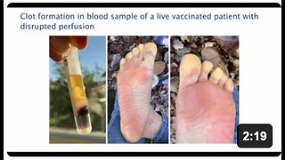 Everything They Said About The Death Vax Was True