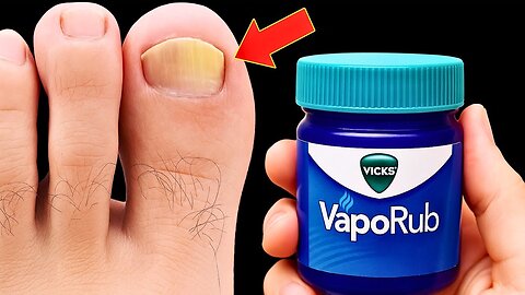 I Had No Idea This KILLS Nail Fungus FAST!