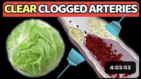 "7 Best Vegetables for Artery Cleansing and Heart Attack Prevention"