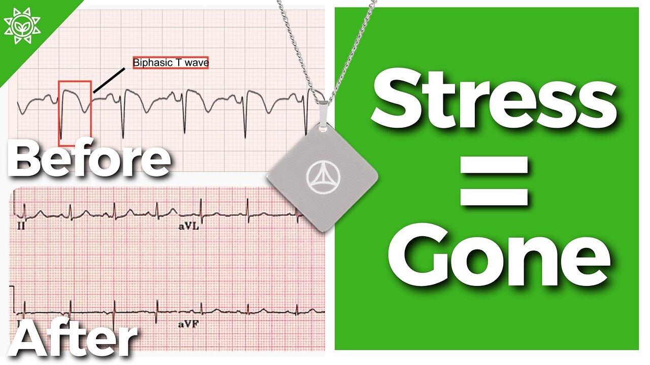How To Mitigate EMF Stress in Seconds?