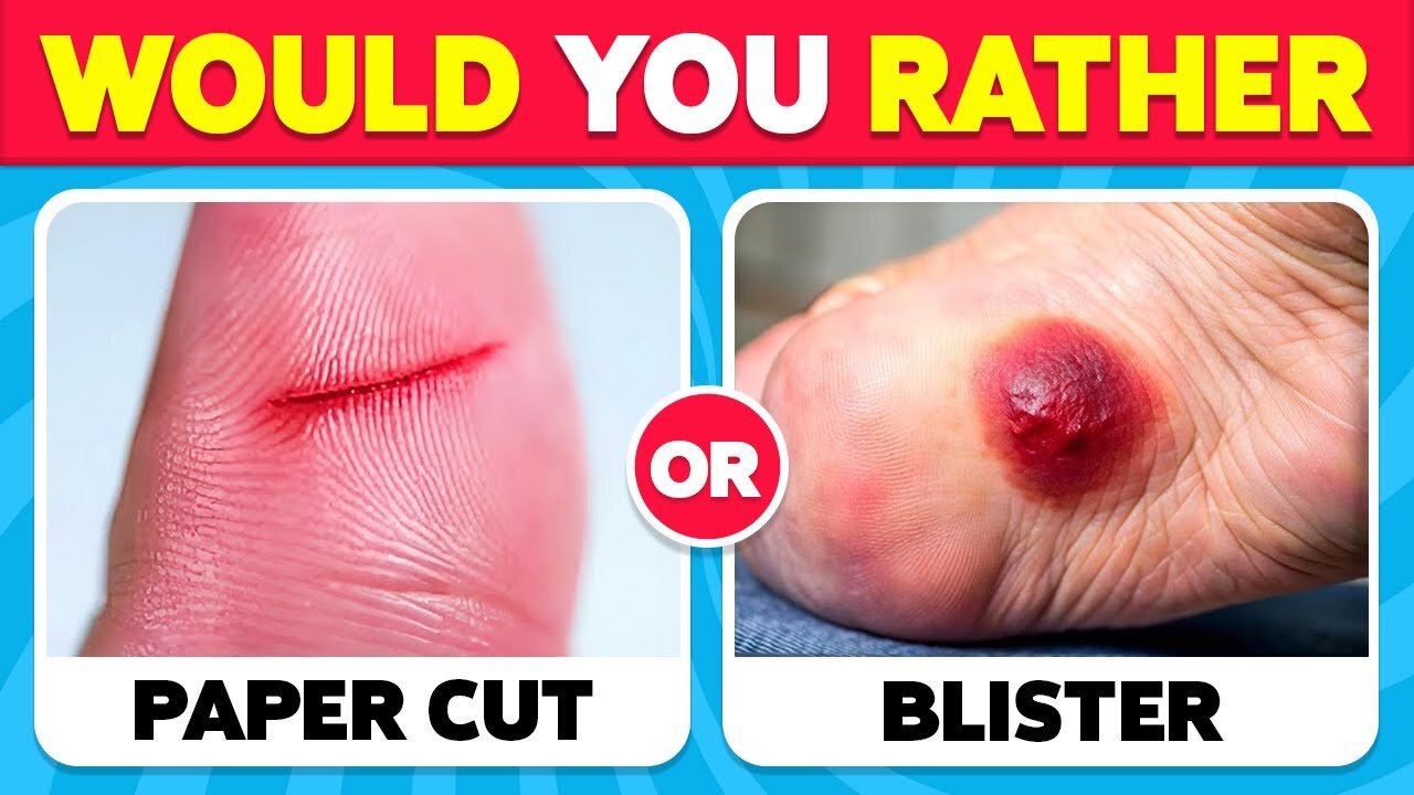 Would You Rather...? | 100 HARDEST Choices Ever! Extreme Edition!