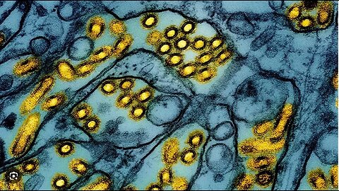 American Dies from Bird Flu Strain, Becoming World’s First Death