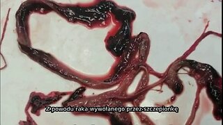 Upadek Kabały- Kontynuacja, część 26: COVID-19 Podsumowanie LUDOBÓJSTWA