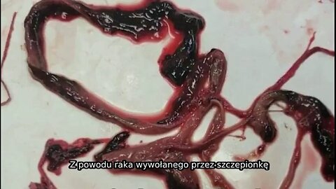 Upadek Kabały- Kontynuacja, część 26: COVID-19 Podsumowanie LUDOBÓJSTWA