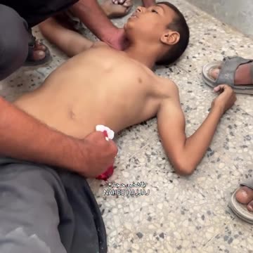 A child who was shot in the stomach by a quadcopter drone in the Sheikh Radwan neighborhood