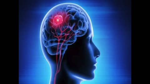 Muhammad Had Epilepsy: Here The Medical Case .