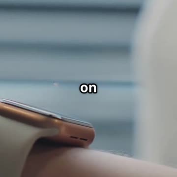 The Watch Everyone's Obsessed With! ⌚️