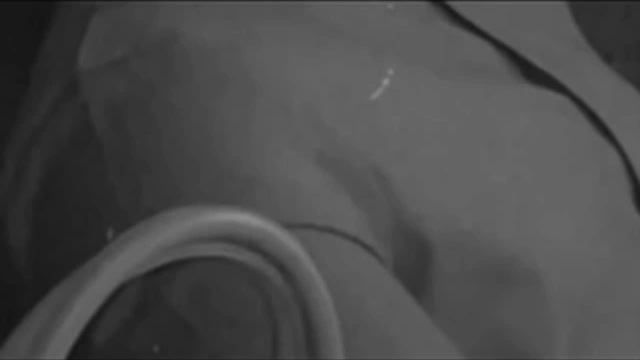 Bb