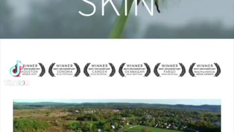 🚨 WATCH: Ticks Are a Bio-Weapon!