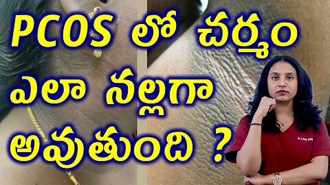 PCOS లో చర్మం ఎలా నల్లగా మారుతుంది? How PCOS Causes Dark Skin Acanthosis Nigricans Treatment Cure
