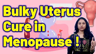 Best Non-Surgical Treatment for Bulky Uterus in Menopause | Treatment & Cure | Homeopathy, Medicine