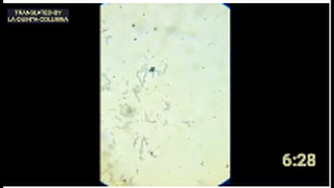 "Light Microscopic Analysis of Dried Hepatitis B Vaccine Drop Over 3 Days"