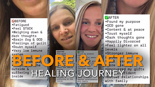 Before & After Healing Journey