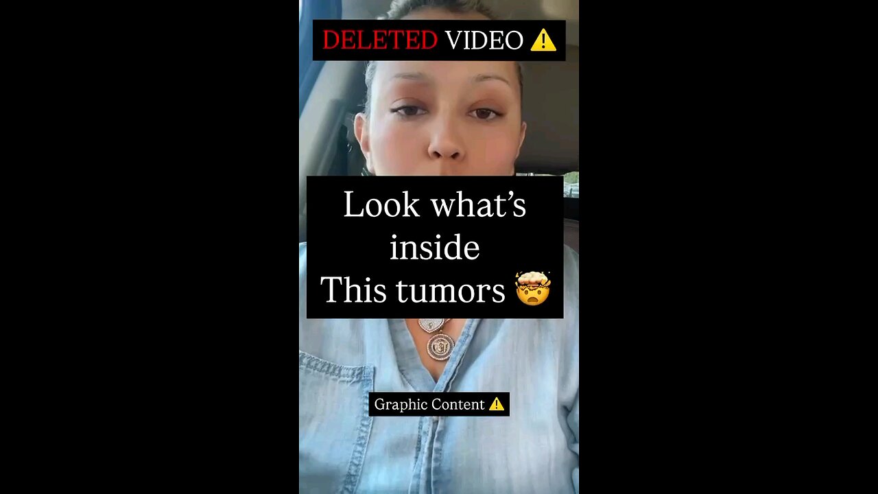 Are Parasites Encapsulated In Tumours?