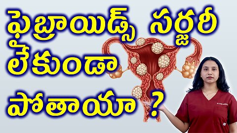 ఫైబ్రాయిడ్స్ సర్జరీ లేకుండా పోతాయా? Uterine Fibroids Causes Treatment Without Surgery Cure Medicine