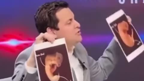 😂🐬 When You Accidentally Ultrasound a Dolphin Fetus! Epic Pregnancy Fail | FunFM