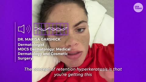 TikTok user goes viral for not washing her face | USA NEWS | CENTER FRAME