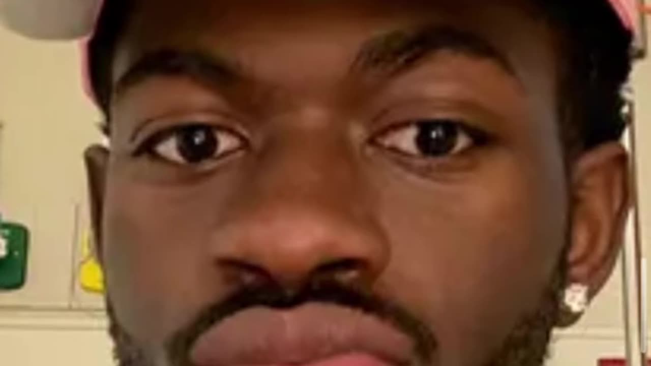 Lil Nas X Can't Move Half His Face!!
