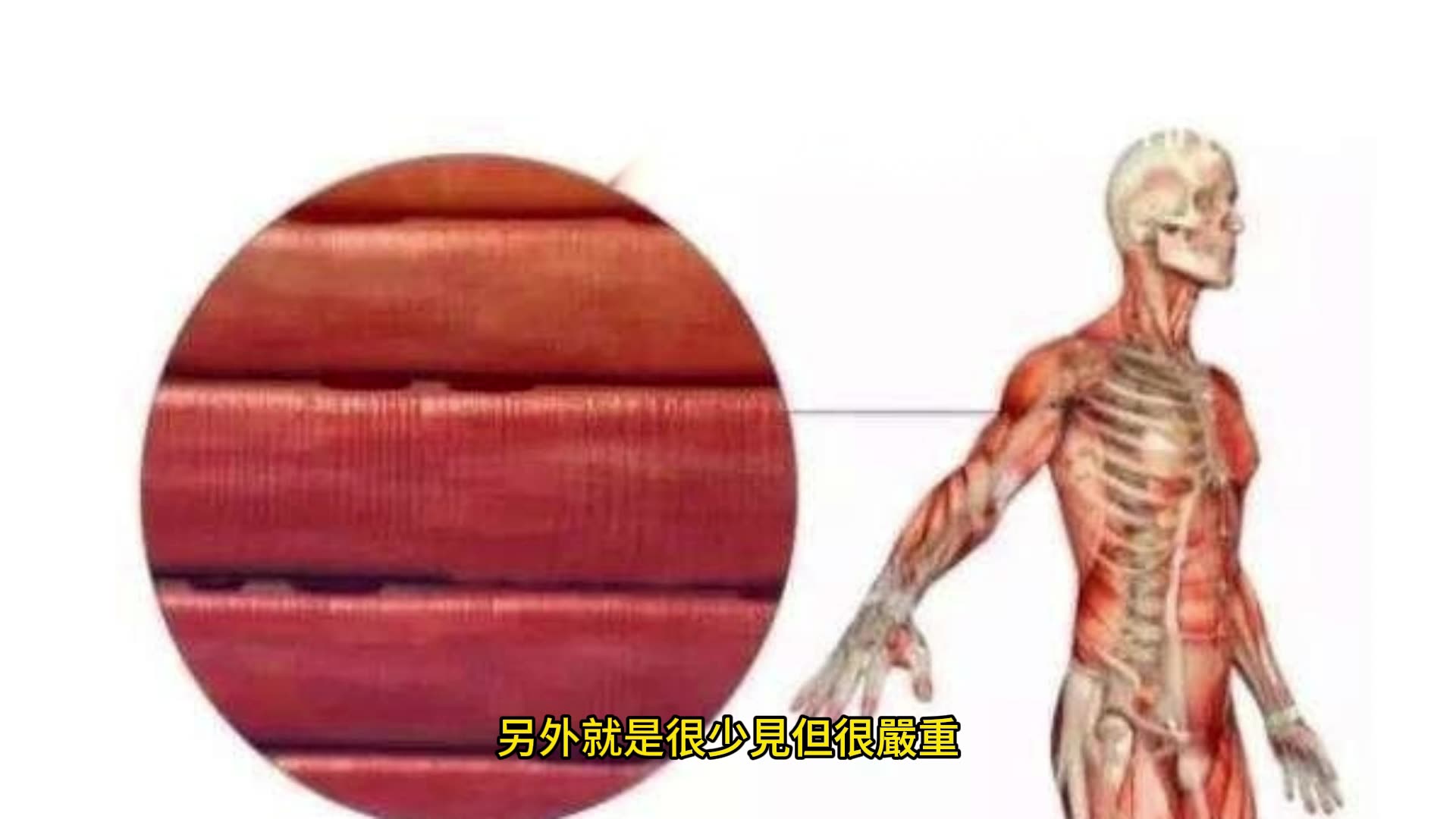 糖尿病服用Statins 心血管風險降三成