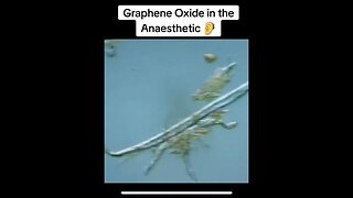 All dental anesthetics now seem to have graphene oxide in them. How to remove