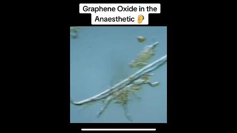 All dental anesthetics now seem to have graphene oxide in them. How to remove